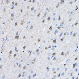 Anti-HP1 gamma antibody used in IHC (Paraffin sections) (IHC-P). GTX55664