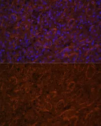 Anti-ICOS antibody used in IHC (Paraffin sections) (IHC-P). GTX55669