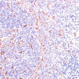 Anti-IKK epsilon antibody used in IHC (Paraffin sections) (IHC-P). GTX55673