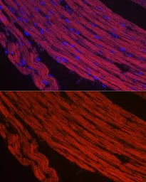 Anti-MYH1 antibody used in IHC (Paraffin sections) (IHC-P). GTX55717