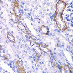 Anti-Myosin 1C antibody used in IHC (Paraffin sections) (IHC-P). GTX55719