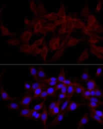 Anti-NDP52 antibody used in Immunocytochemistry/ Immunofluorescence (ICC/IF). GTX55720