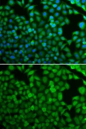 Anti-NDRG1 antibody used in Immunocytochemistry/ Immunofluorescence (ICC/IF). GTX55721