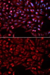 Anti-NR1I3 antibody used in Immunocytochemistry/ Immunofluorescence (ICC/IF). GTX55731