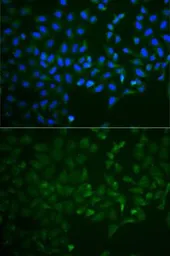 Anti-OPG antibody used in Immunocytochemistry/ Immunofluorescence (ICC/IF). GTX55734