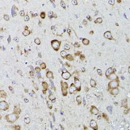 Anti-PDI antibody used in Immunocytochemistry/ Immunofluorescence (ICC/IF). GTX55742