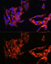 Anti-PI3 kinase p110 alpha antibody used in Immunocytochemistry/ Immunofluorescence (ICC/IF). GTX55747