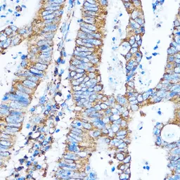 Anti-PI3 kinase p110 alpha antibody used in IHC (Paraffin sections) (IHC-P). GTX55747