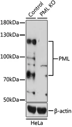 Anti-PML antibody used in Western Blot (WB). GTX55751
