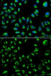 Anti-PPP4C antibody used in Immunocytochemistry/ Immunofluorescence (ICC/IF). GTX55756
