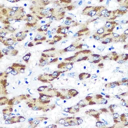 Anti-Presenilin 1 antibody used in IHC (Paraffin sections) (IHC-P). GTX55757