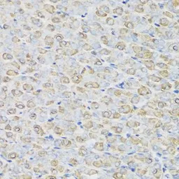 Anti-REG III alpha antibody used in IHC (Paraffin sections) (IHC-P). GTX55778