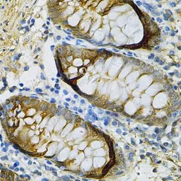 Anti-SELENBP1 antibody used in IHC (Paraffin sections) (IHC-P). GTX55788