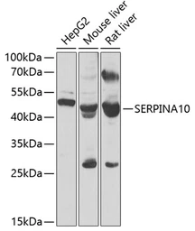 Anti-SERPINA10 antibody used in Western Blot (WB). GTX55791