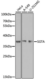 Anti-SGTA antibody used in Western Blot (WB). GTX55797