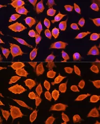Anti-SIAH1 antibody used in Immunocytochemistry/ Immunofluorescence (ICC/IF). GTX55799