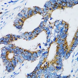 Anti-SIAH1 antibody used in IHC (Paraffin sections) (IHC-P). GTX55799