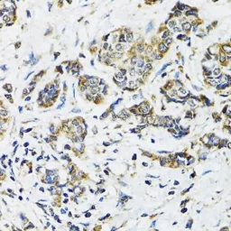 Anti-SSBP1 antibody used in IHC (Paraffin sections) (IHC-P). GTX55806