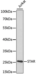 Anti-StAR antibody used in Western Blot (WB). GTX55809