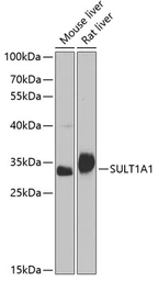 Anti-SULT1A1 antibody used in Western Blot (WB). GTX55811