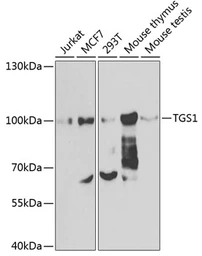 Anti-PIMT antibody used in Western Blot (WB). GTX55815
