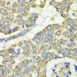 Anti-TUFM antibody used in IHC (Paraffin sections) (IHC-P). GTX55825