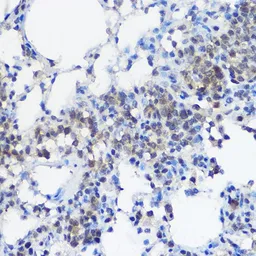 Anti-UBE2I antibody used in IHC (Paraffin sections) (IHC-P). GTX55830