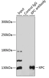 Anti-XPC antibody used in Immunoprecipitation (IP). GTX55845