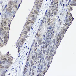 Anti-XPC antibody used in IHC (Paraffin sections) (IHC-P). GTX55845