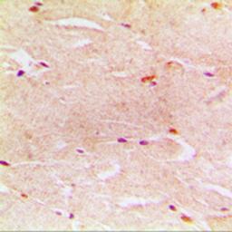 Anti-gamma 2 Actin antibody used in IHC (Paraffin sections) (IHC-P). GTX55849