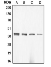 Anti-gamma 2 Actin antibody used in Western Blot (WB). GTX55849