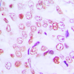 Anti-Cyclin G1 antibody used in IHC (Paraffin sections) (IHC-P). GTX55852