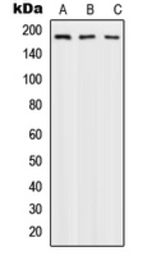 Anti-DNA Polymerase alpha 1 antibody used in Western Blot (WB). GTX55877