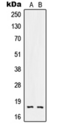 Anti-RNASE3 antibody used in Western Blot (WB). GTX55887