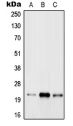 Anti-RAB31 antibody used in Western Blot (WB). GTX55929