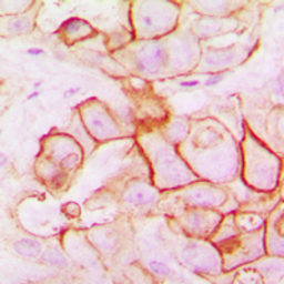 Anti-PMEPA1 antibody used in IHC (Paraffin sections) (IHC-P). GTX55966