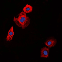 Anti-COL20A1 antibody used in Immunocytochemistry/ Immunofluorescence (ICC/IF). GTX55969
