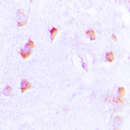 Anti-COL20A1 antibody used in IHC (Paraffin sections) (IHC-P). GTX55969