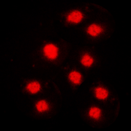 Anti-Cyclin A1 antibody used in Immunocytochemistry/ Immunofluorescence (ICC/IF). GTX56034