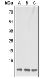 Anti-COX7B antibody used in Western Blot (WB). GTX56091