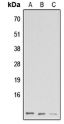 Anti-GNG13 antibody used in Western Blot (WB). GTX56099