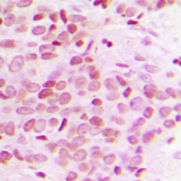 Anti-MED12 antibody used in IHC (Paraffin sections) (IHC-P). GTX56106