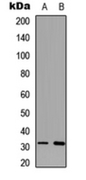 Anti-MARCH-I antibody used in Western Blot (WB). GTX56127
