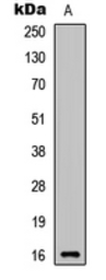 Anti-CYTL1 antibody used in Western Blot (WB). GTX56131