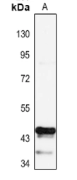 Anti-PAX1 antibody used in Western Blot (WB). GTX56136