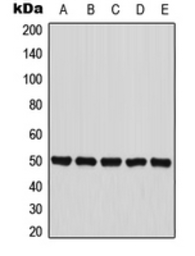 Anti-PANK2 antibody used in Western Blot (WB). GTX56190