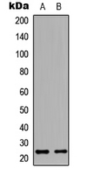 Anti-HAND1 antibody used in Western Blot (WB). GTX56230