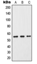 Anti-Cytochrome P450 2C9 antibody used in Western Blot (WB). GTX56285