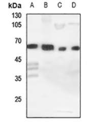 Anti-CYP11A1 antibody used in Western Blot (WB). GTX56293
