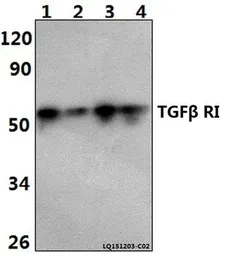 Anti-TGF beta Receptor I antibody used in Western Blot (WB). GTX57156